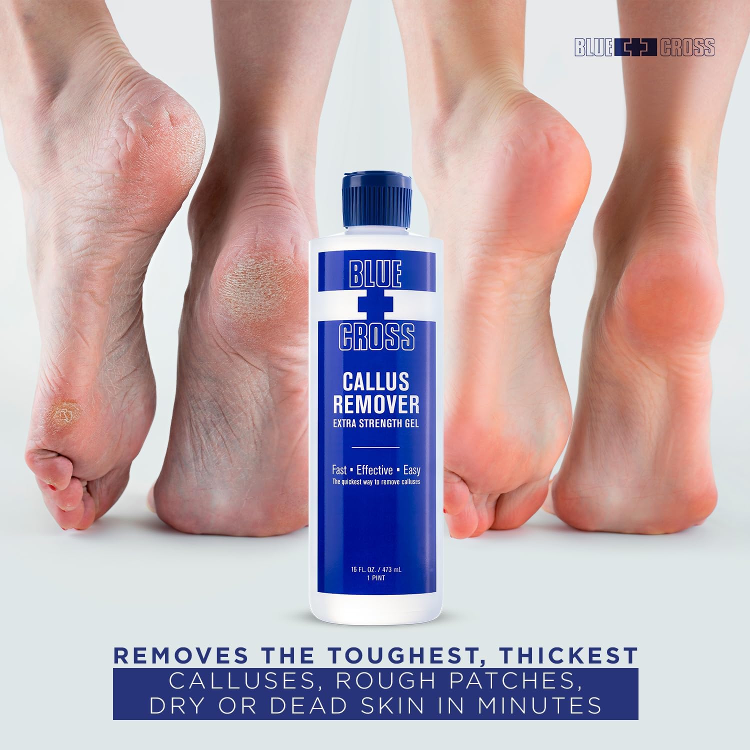 Blue Cross Callus Remover Extra Strength Gel 16oz