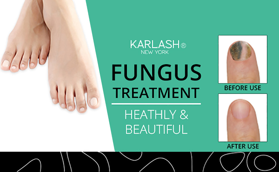 Karlash Finger & Toenail Fungus Solution EXTRA STRONG