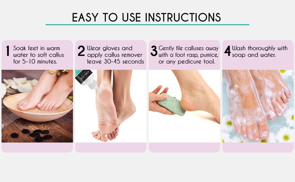 Karlash Callus Remover Gel and Foot Pumice Stone Scrubber Kit 4 oz