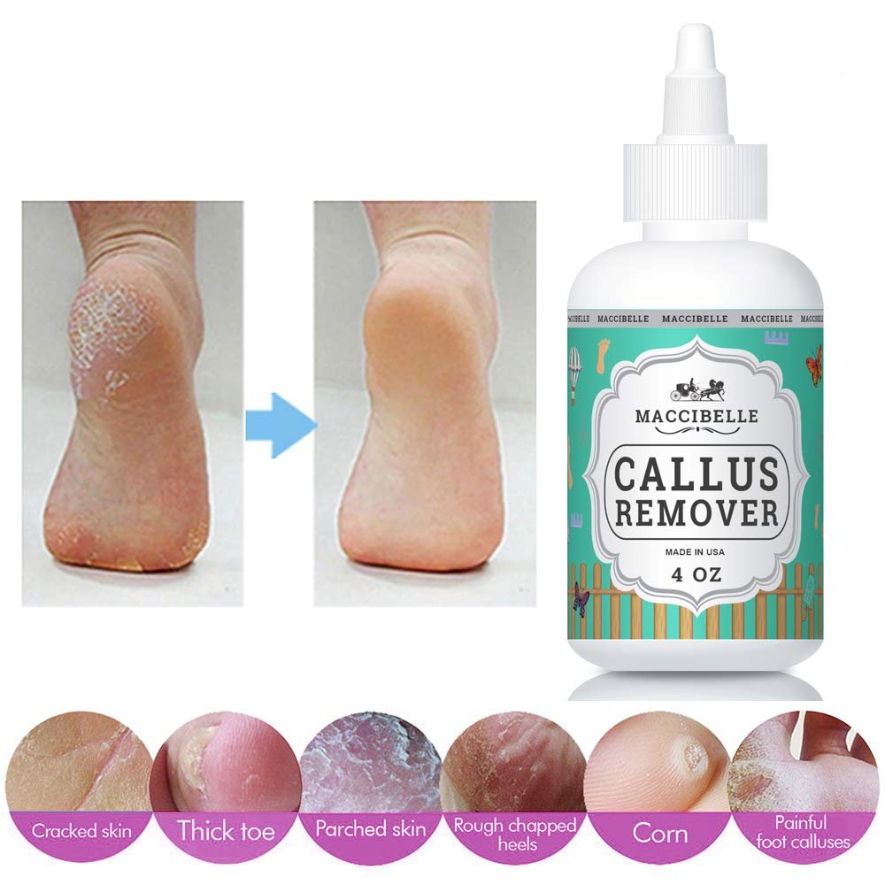 Maccibelle Callus Remover EXTRA For Feet, Professional Callus and Corn Eliminator Liquid Gel