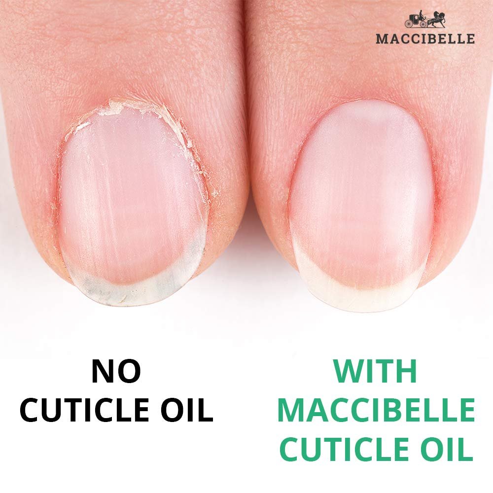 Maccibelle Cuticle Oil Set of 3 Oil Flavors,Help to Heals Dry Cracked Cuticles 0.5 oz