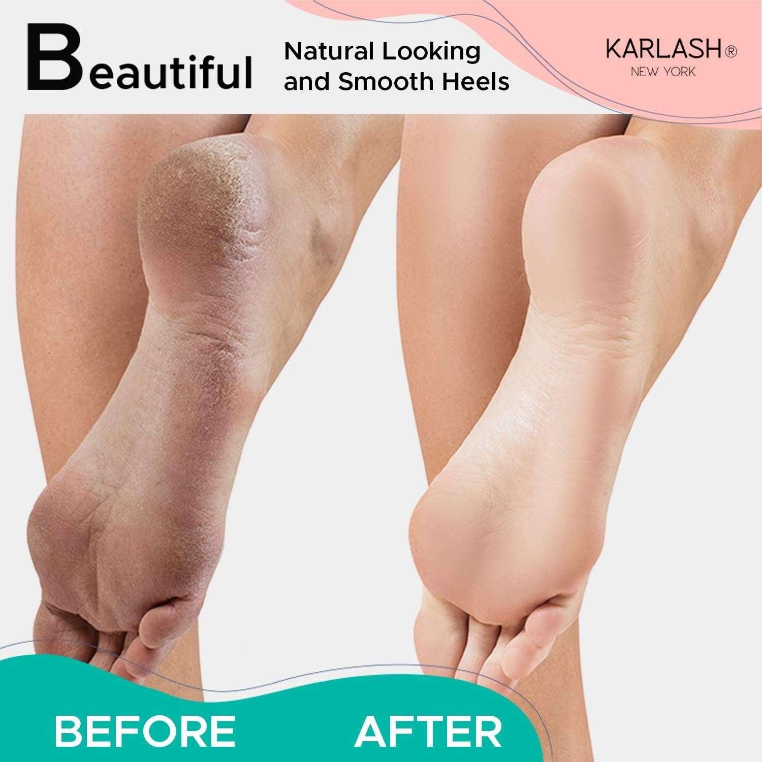 Karlash 2-Sided Nickel Foot File for Callus Trimming and Callus Removal, Mint